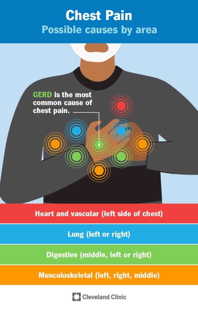 Understanding Anxiety Induced Chest Pain Causes Symptoms And 