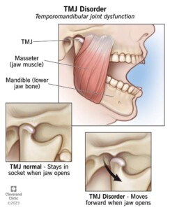 TMJ Disorder: Constant Symptoms Experienced by Diagnosed Individuals