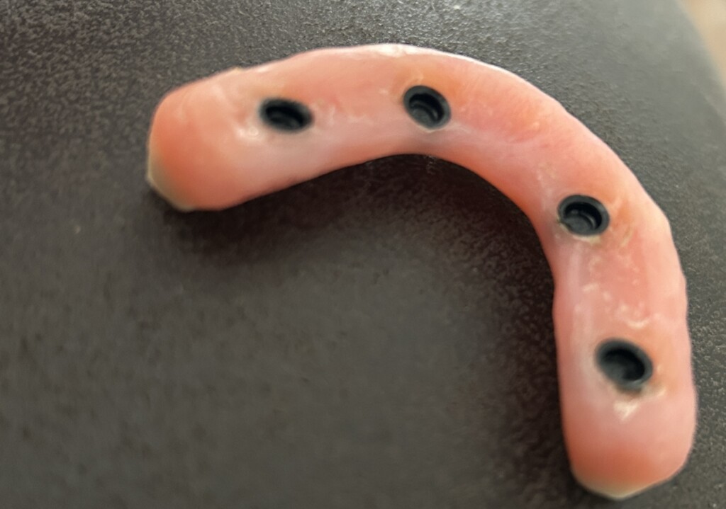 A Transformed Smile: Exploring the World of Small Full Mouth Dental Denture Bridges