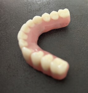 My Implant Retained Denture Journey: Day 5 Update and Dental Triumph