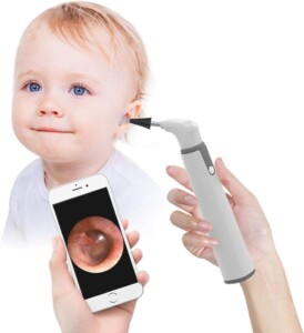 The Revolutionary Wireless Otoscope: A Game-Changer in Personal Health