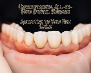 Understanding All-on-Four Dental Bridges: Adjusting to Your New Smile