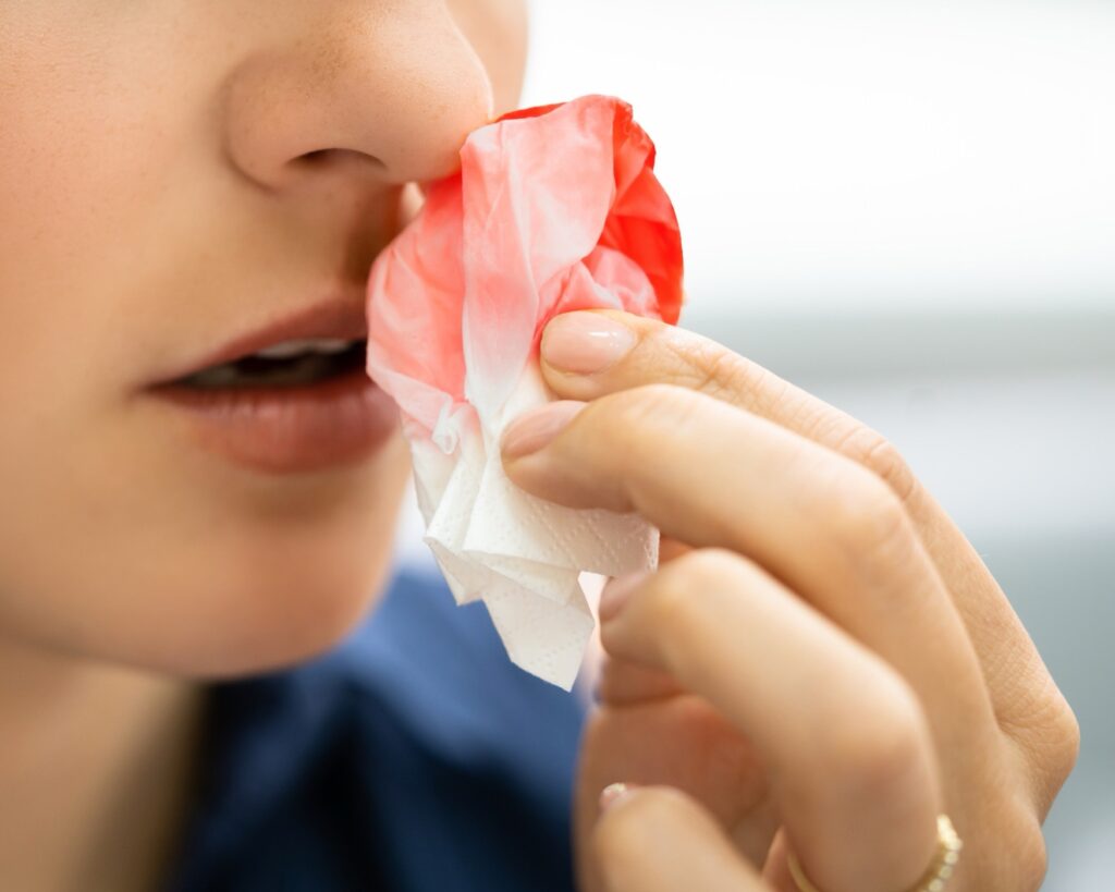 Frequent Nosebleeds in Children: Causes, Management, and When to Seek Help