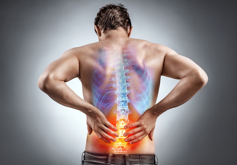 Recognizing the Symptoms Linking Lower Back to Neck and Shoulder Pain