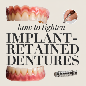 How To Tighten Implant-Retained Dentures At Home