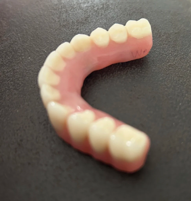 How To Tighten Implant-Retained Dentures At Home