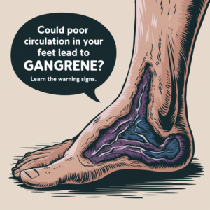 Spotting the Signs of Foot Gangrene and What to Do About It